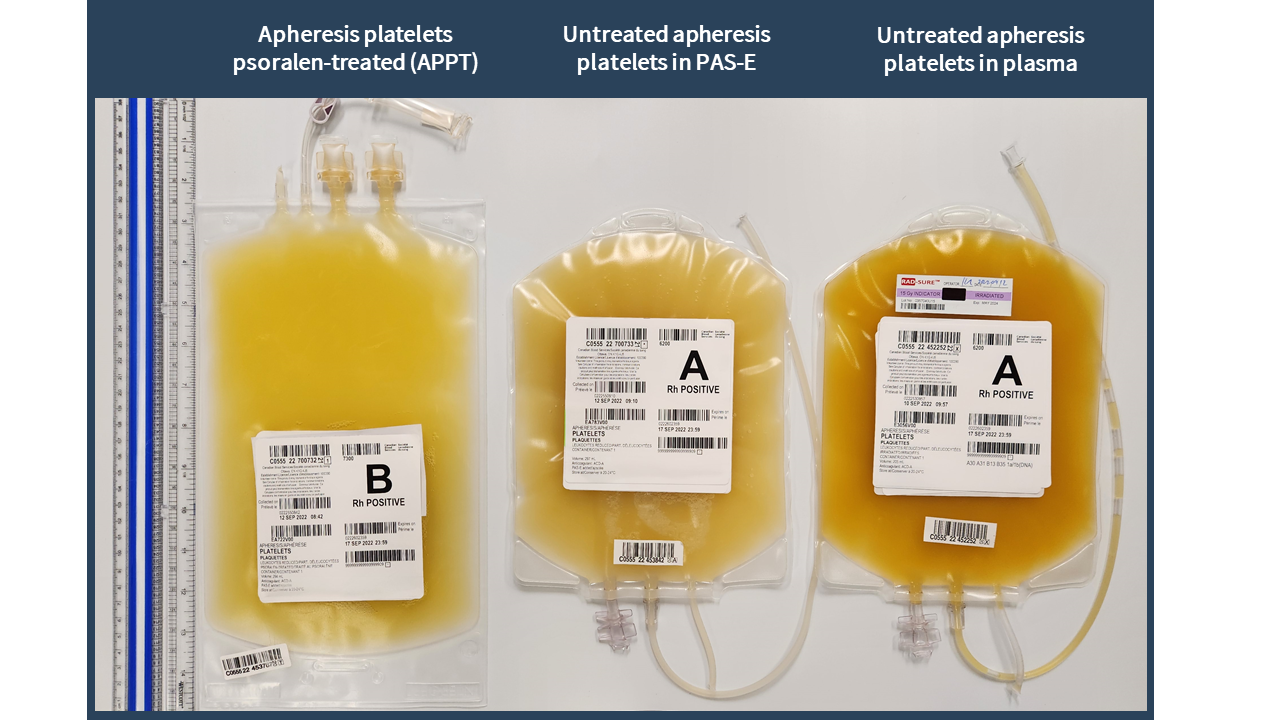Pathogenreduced platelets Professional Education